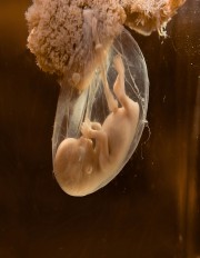 The Quran on Human Embryonic Development